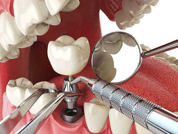 Best Cracked Tooth Emergency Dentist  in , OK